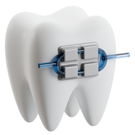 歯列矯正器具  3D Icon