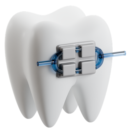 Dental Braces On Tooth  3D Icon