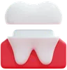 Dental Crown