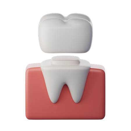 Dental Crown  3D Icon