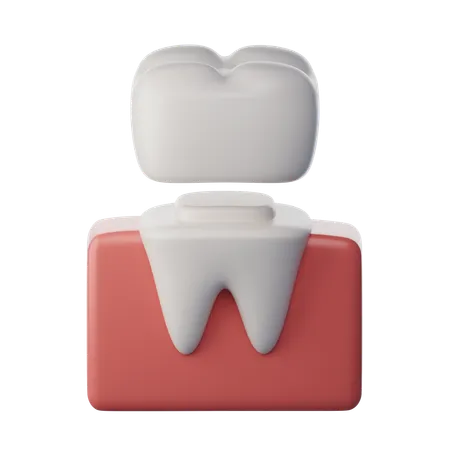 Dental Crown  3D Icon