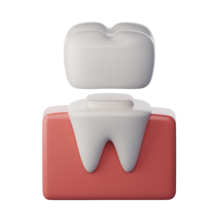 Dental Crown  3D Icon