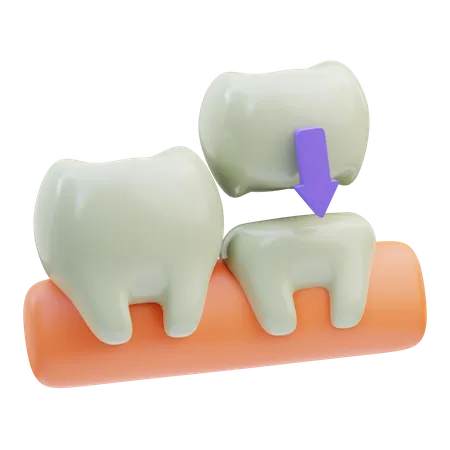 Dental Crown  3D Icon