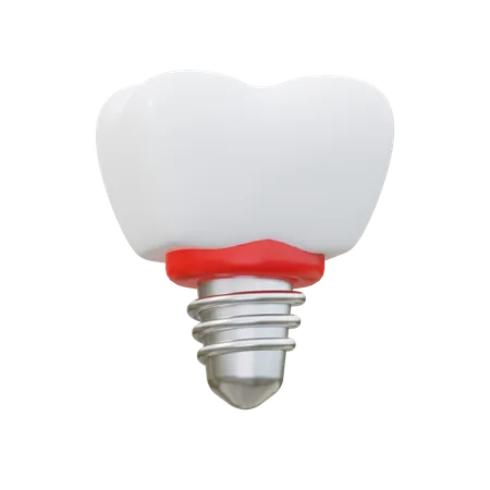 Dental Implant  3D Icon