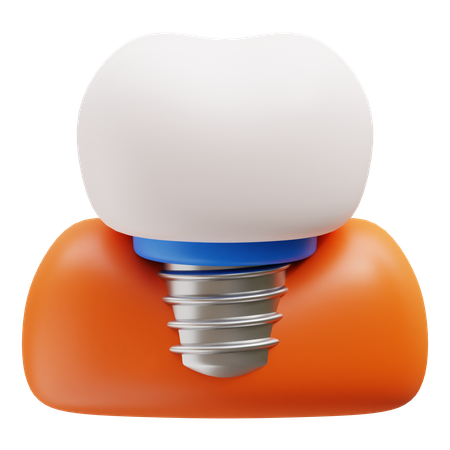 Dental Implant  3D Icon