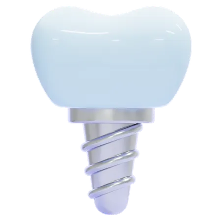 Dental Implant  3D Icon
