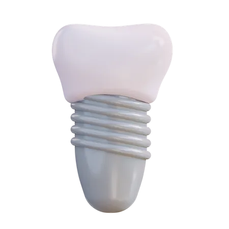 Dental Implant  3D Icon