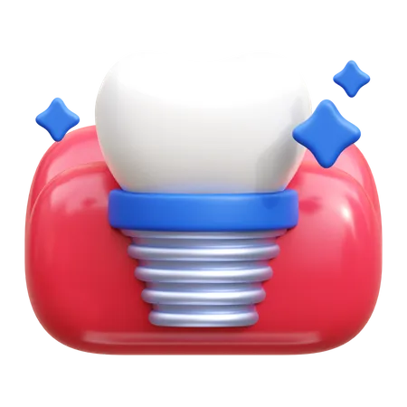 Dental Implant  3D Icon