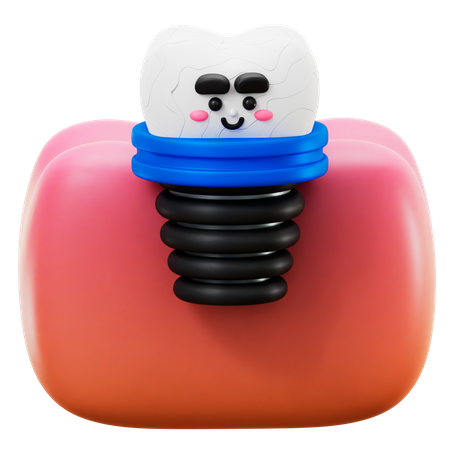 Dental Implant  3D Icon