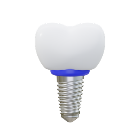 Dental Implant  3D Icon