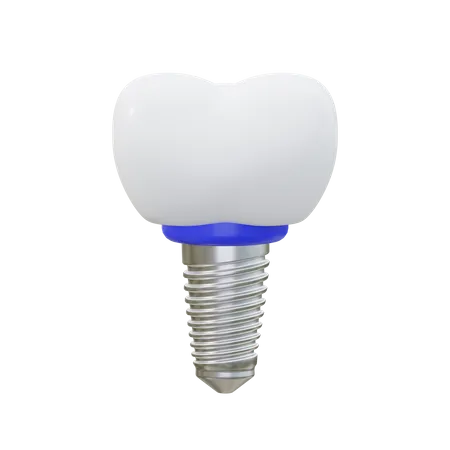 Dental Implant  3D Icon