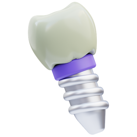 Dental Implant  3D Icon