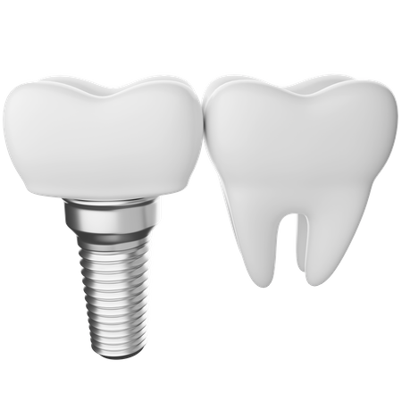 Dental implant  3D Illustration