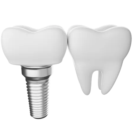 Dental implant  3D Illustration