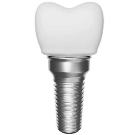 Dental implant 3D Illustration