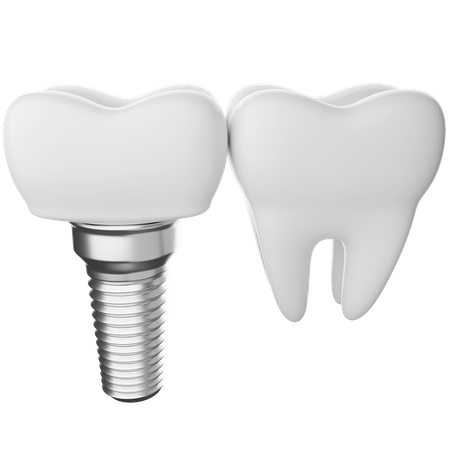 Dental implant 3D Illustration