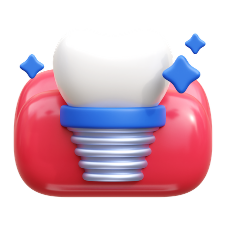 Dental Implant  3D Icon