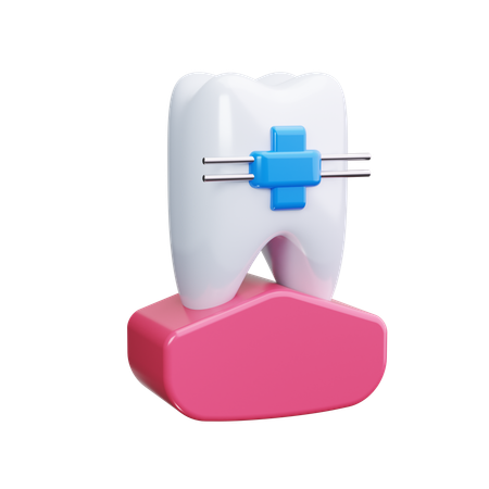 Dental Retainer  3D Icon