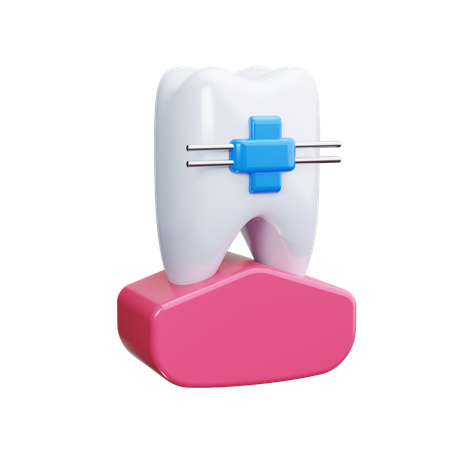Dental Retainer  3D Icon