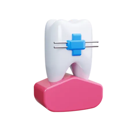 Dental Retainer  3D Icon