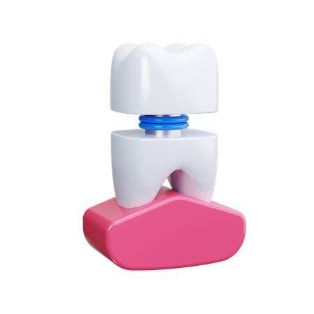 Dental Veneers  3D Icon