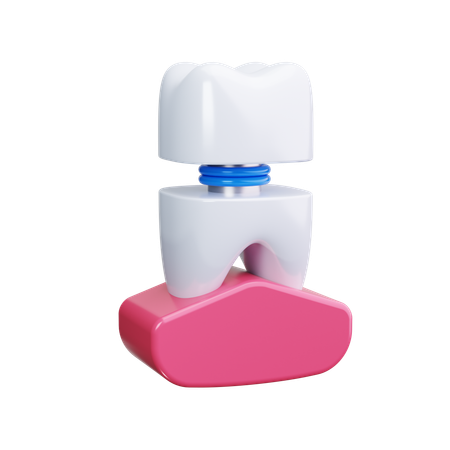 Dental Veneers  3D Icon