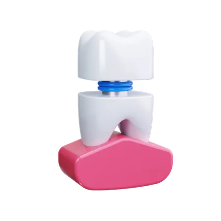 Dental Veneers  3D Icon