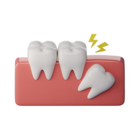 Dente do siso distoangular  3D Icon