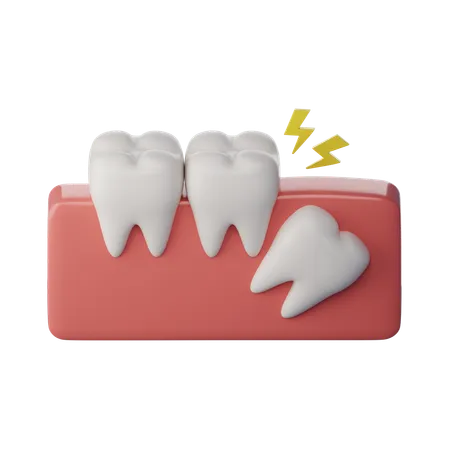 Dente do siso distoangular  3D Icon