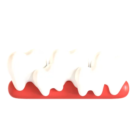 Dentes apinhados  3D Icon