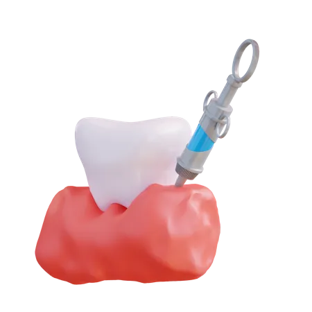 Anesthésie des dents  3D Icon