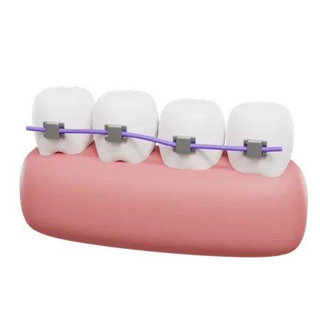 Appareil dentaire  3D Icon