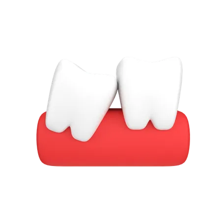 Dents de sagesse  3D Icon