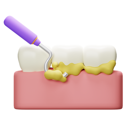 Détartrage des dents  3D Icon