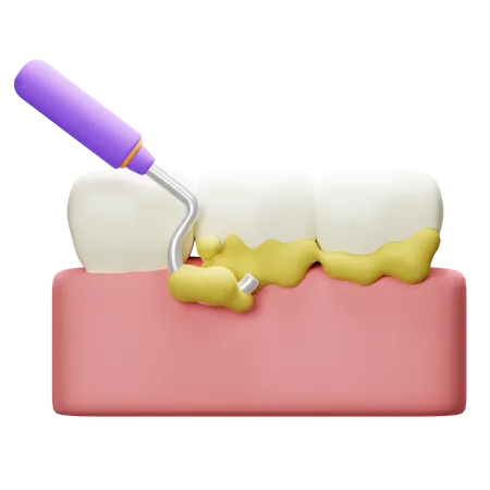 Détartrage des dents  3D Icon