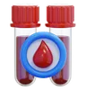 Diabetes Blood Test