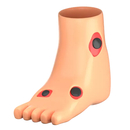 Diabetic Foot  3D Icon