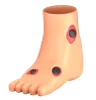 Diabetic Foot