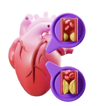 Doença arterial coronária  3D Icon