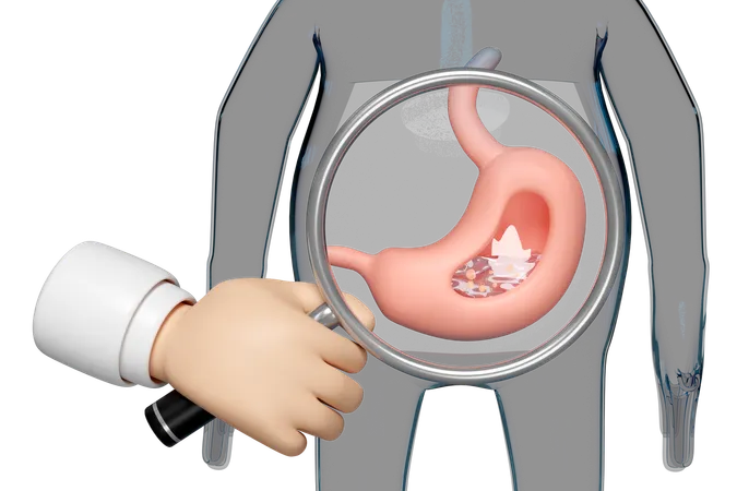 Doença gástrica  3D Icon