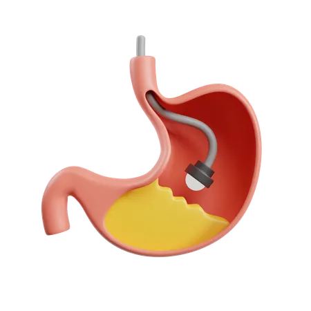 Endoscopy  3D Icon