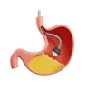 Endoscopy