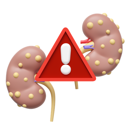 Enfermedad renal crónica  3D Icon