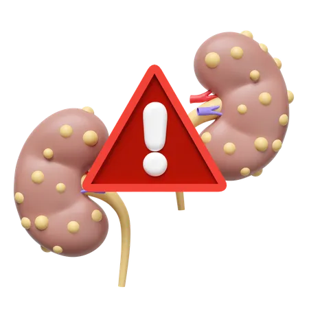 Enfermedad renal crónica  3D Icon