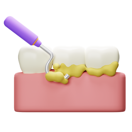 Escamação de dente  3D Icon