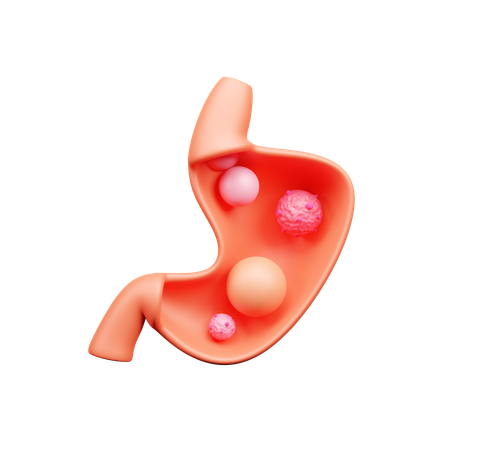 Cáncer de estómago  3D Icon