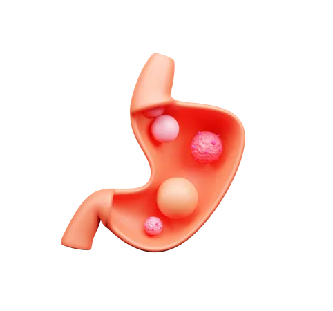 Cáncer de estómago  3D Icon