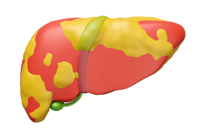 Fatty Liver  3D Icon