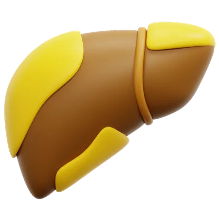 Fatty liver  3D Icon