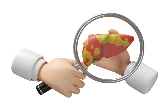 Fatty Liver  3D Icon